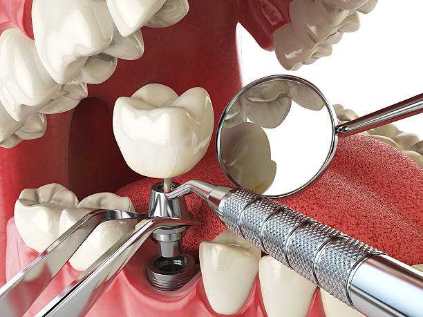Best Emergency Denture Repair in Olivehurst, CA